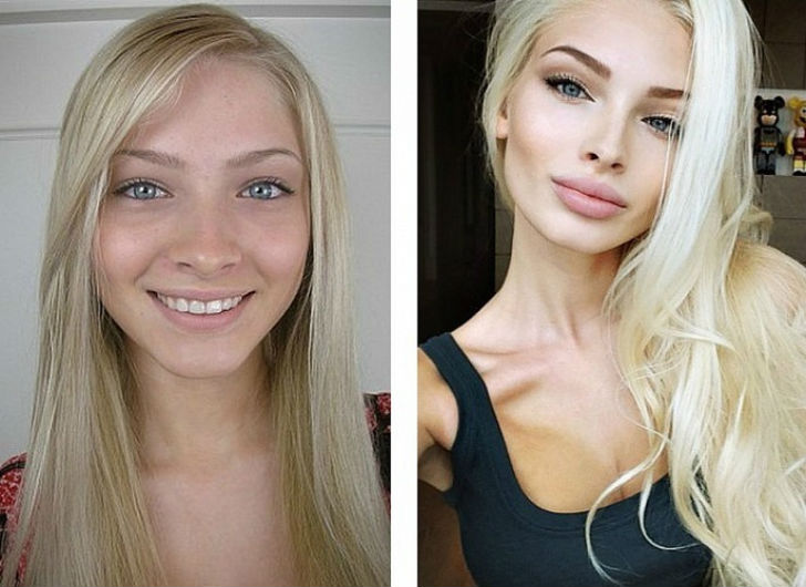 10 российских красавиц до и после пластики (Есть идеи зачем нужны такие губы?)