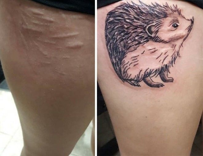 15 татуировок которые превратили шрамы в произведения искусства