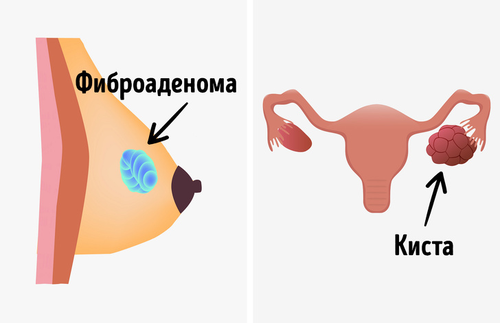 7 отличных новостей для тех, кто панически боится заболеть раком