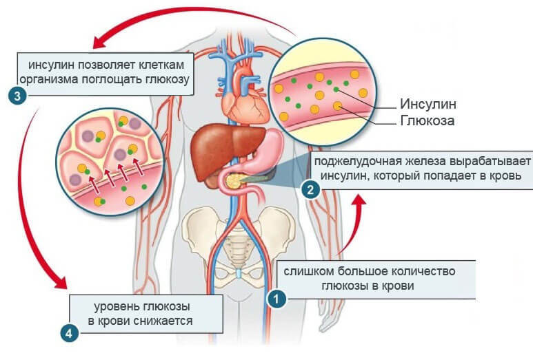 Как понять, что повышен уровень инсулина