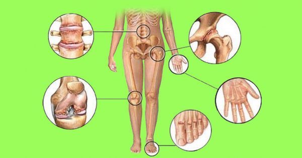 thumb3-600x315 (1)