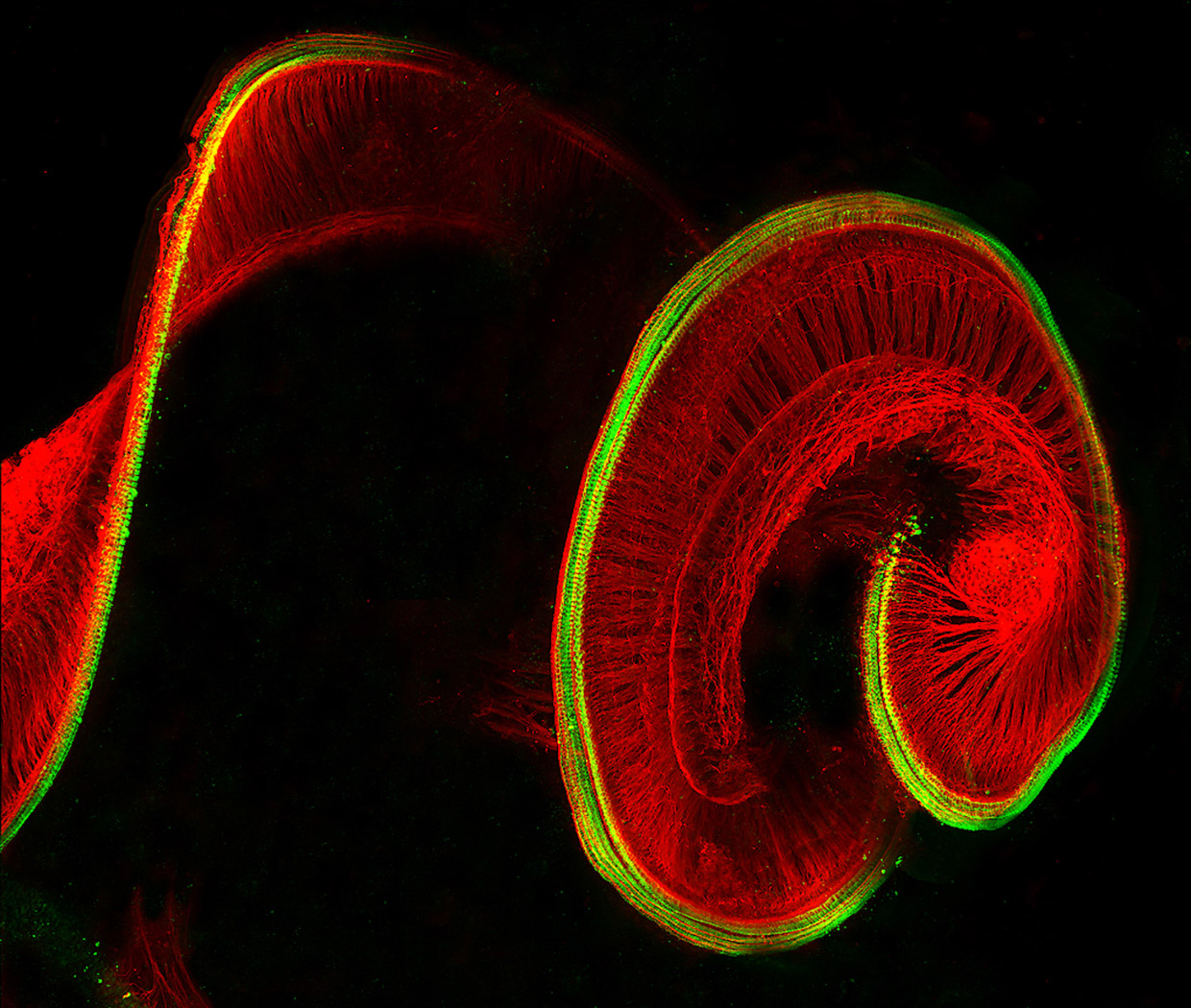 Победители конкурса микрофотографии Nikon Small World 2017 Победители конкурса микрофотографии Nikon Small World 2017