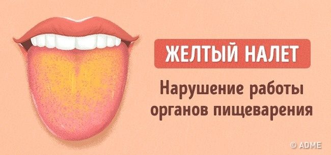 Что расскажет цвет языка о вашем здоровье