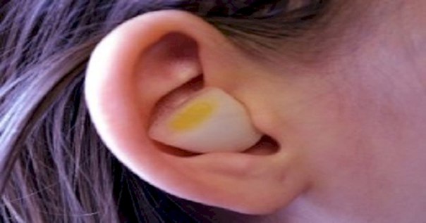 This is what happens when you put a piece of onion in your ear. Why didn&#39;t I know about this before? 