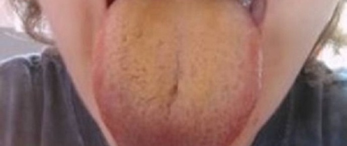     –    
