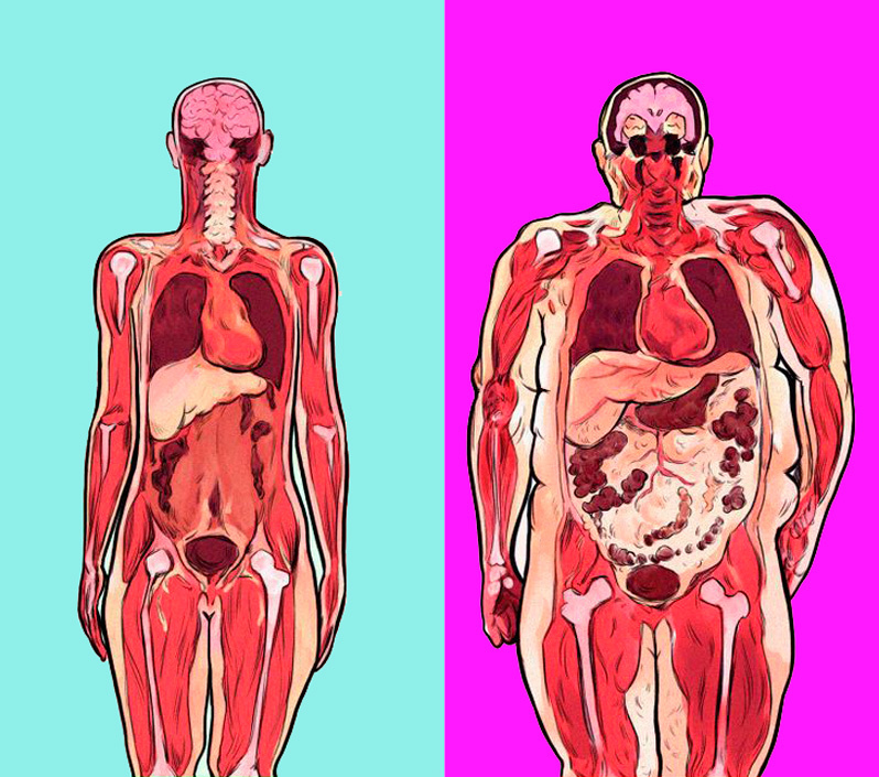 В чем опасность висцерального жира
