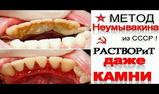 -l1ihEk77PZ