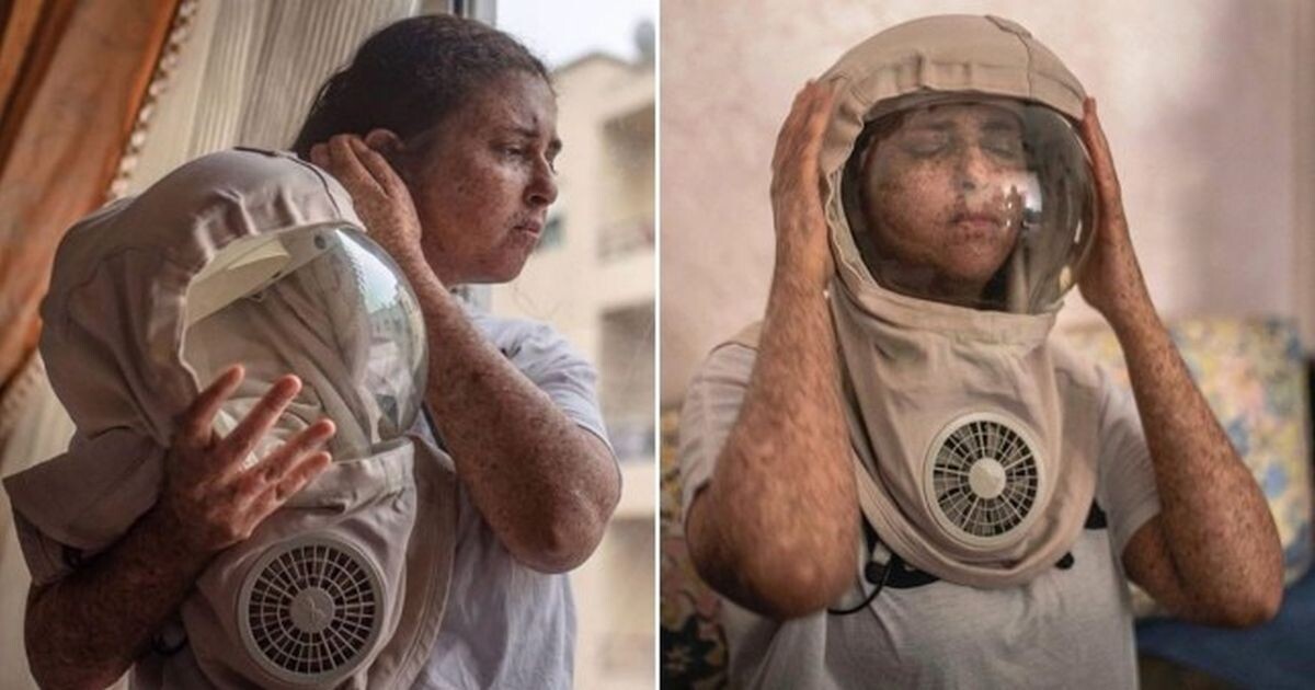 Из-за редкой аллергии на солнце женщина из Марокко ходит в скафандре