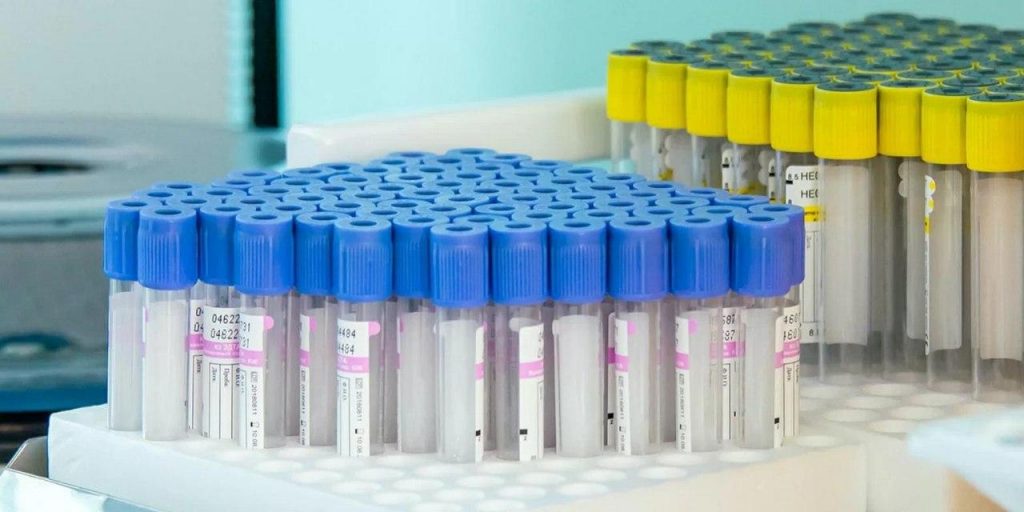 Иммунитет к COVID-19 уже формируется у 17,4% москвичей