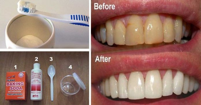 3b601f46386987c6c536ea5948e351df--teeth-health-dental-health