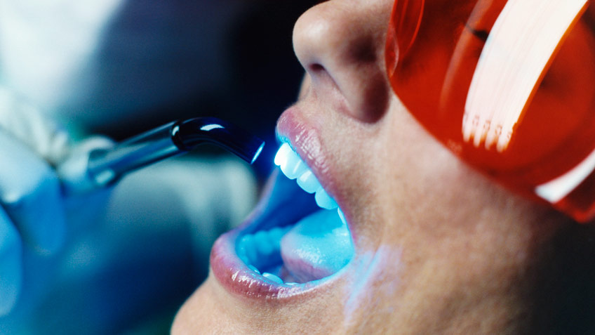 Отбелить зубы и улучшить зрение. Риски популярных процедур и как их избежать