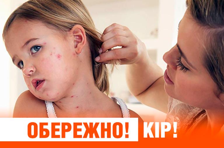 Украинская зараза убивает десятки людей от Галиции до Киева и Одессы Украинская зараза убивает десятки людей от Галиции до Киева и Одессы