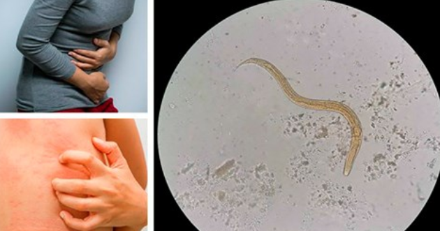 8 признаков, указывающих на паразитов в организме
