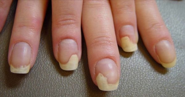 thumb1-600x315