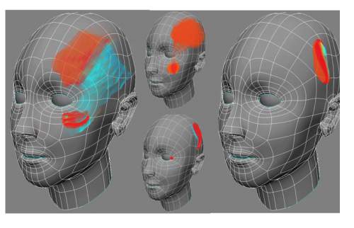 Are-You-Suffering-From-Migraines-And-Headaches-It-Might-Be-Caused-By-THIS-Vitamin-Deficiency