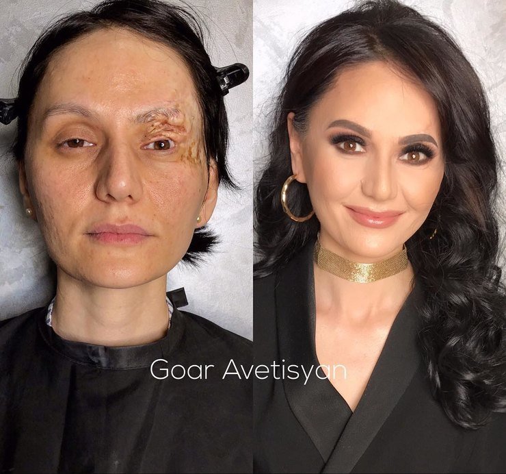 Умение профессионала без фотошопа: мейкап для трудной кожи от Гоар Аветисян Умение профессионала без фотошопа: мейкап для трудной кожи от Гоар Аветисян