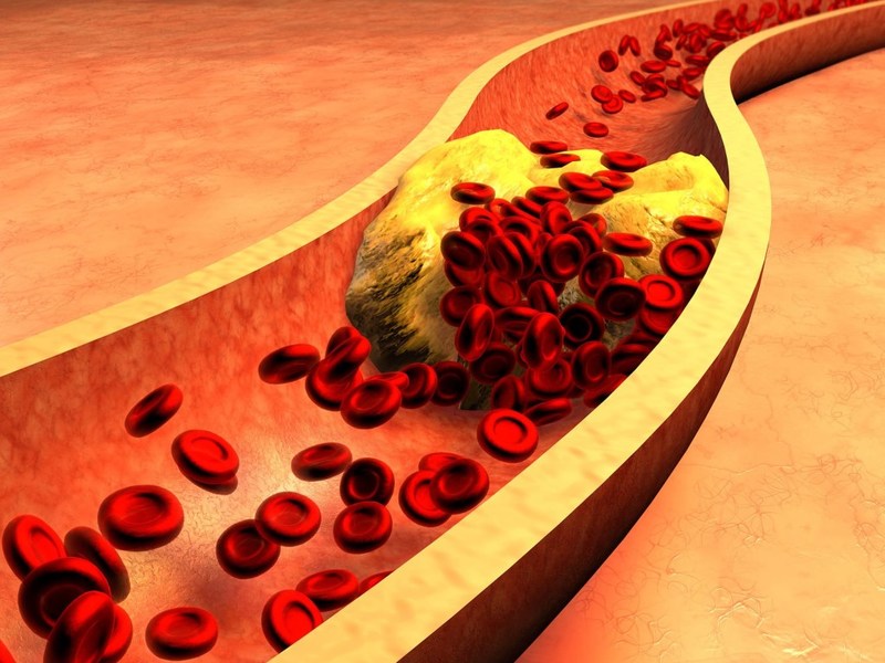 Факты о холестерине, о которых мало кто знает