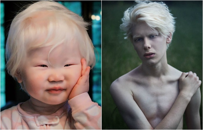 «Ледяная красота»: 27 снимков людей с совершенно нестандартной внешностью