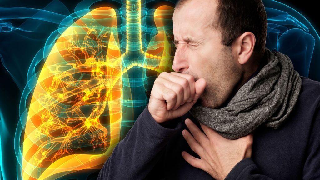 Как дома самостоятельно выявить пневмонию? Главные симптомы заболевания