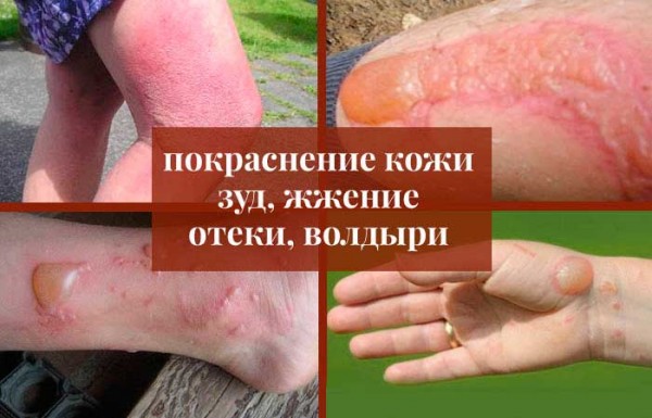 12 интересных фактов про борщевик Сосновского