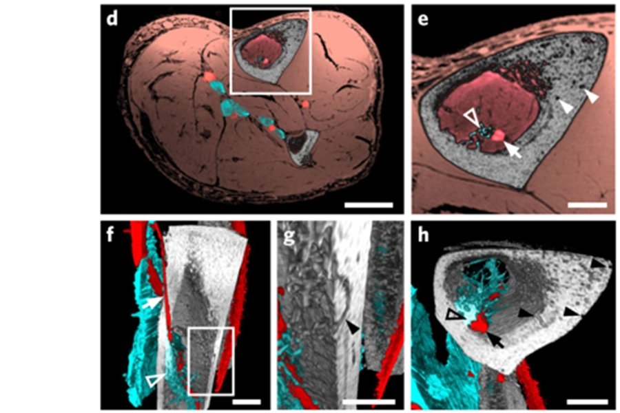 Немецкие ученые обнаружили в человеческих костях кровеносные сосуды