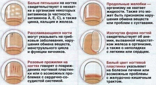 Ногти стали какими-то ребристыми что это значит Ногти стали какими-то ребристыми что это значит