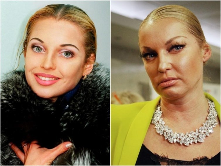 Анастасия Волочкова, 42 года внешность, возраст, звезды, знаменитости, красота