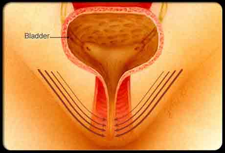 Действие тазовых мышц при выполнении упражнения Кегеля Действие тазовых мышц при выполнении упражнения Кегеля