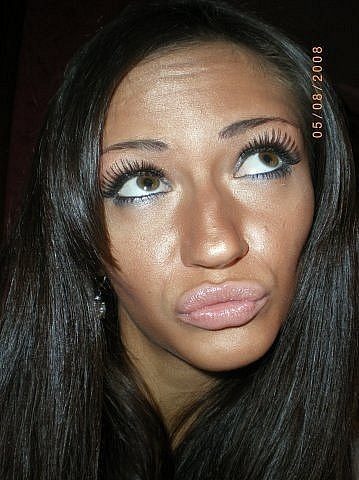 Губастики и их трудовые мазоли