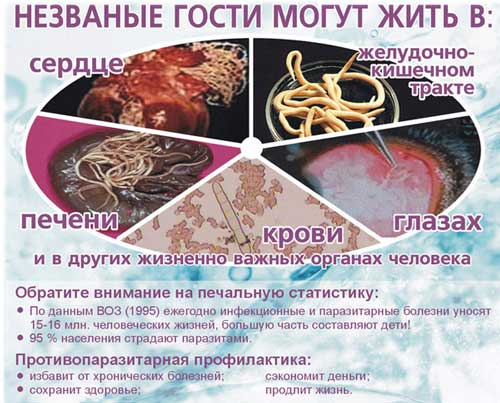 кишечные паразиты у человека фото кишечные паразиты у человека фото
