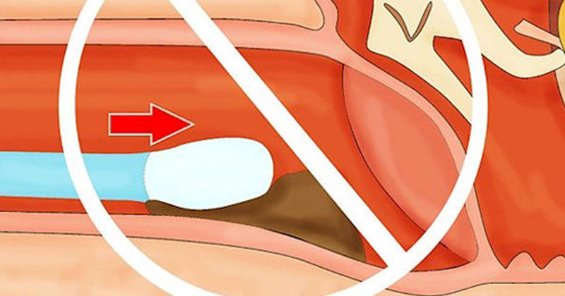 Узнав это, вы перестанете чистить уши ватными палочками - ФОТО