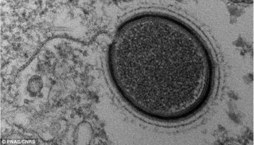 Сибирский вирус виден в оптический микроскоп