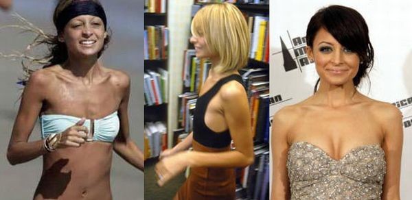 celebrities_before_and_after_boob_jobs_13