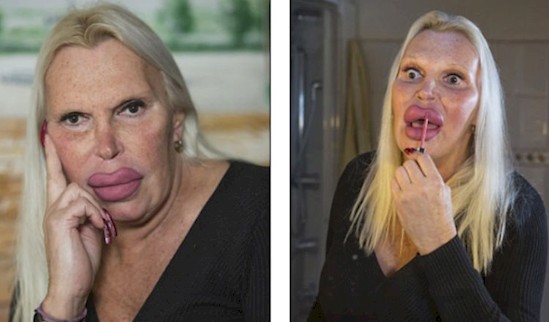            -    . transgender,  , 