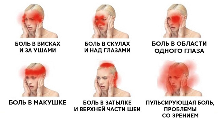 головная боль