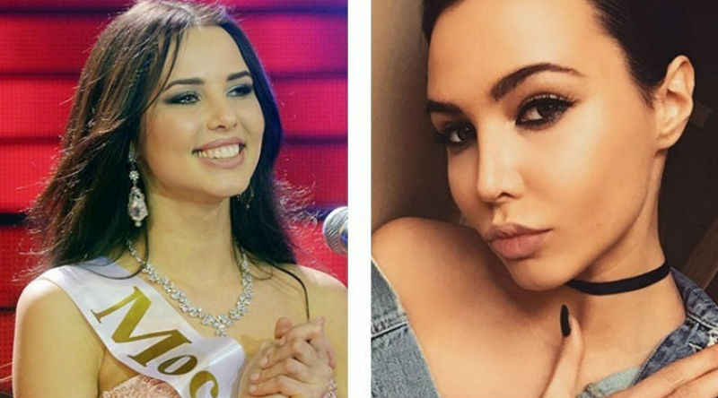 НАШИ КРАСАВИЦЫ ДО И ПОСЛЕ ПЛАСТИКИ