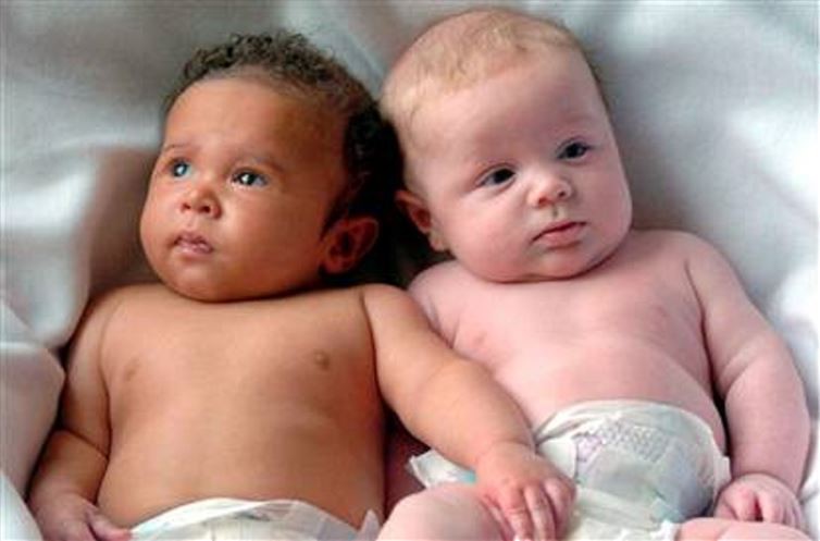 2. Близнецы могут принадлежать к разным расам близнецы, удивительное рядом, факты