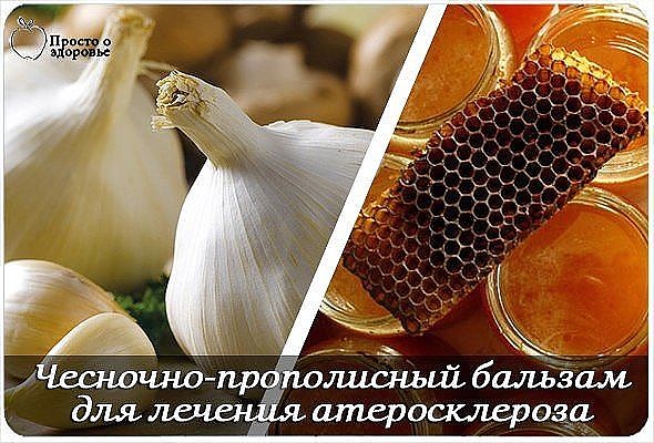 Чесночно-прополисный бальзам для лечения атеросклероза Лечение атеросклероза народными методами