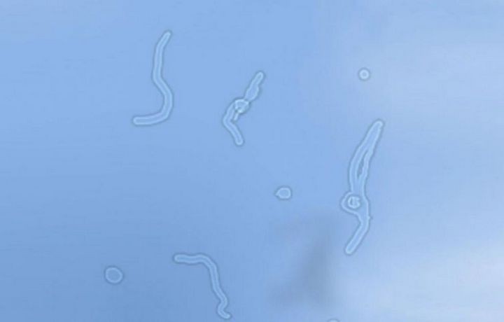 А вы наблюдали такую картину у себя перед глазами? (2) А вы наблюдали такую картину у себя перед глазами? (2)