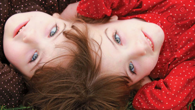 10. Некоторые сиамские близнецы могут видеть глазами друг друга и читать мысли друг друга близнецы, удивительное рядом, факты