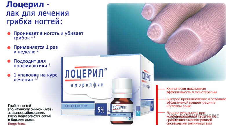 Как лечить грибок ногтей на ногах медикаменты