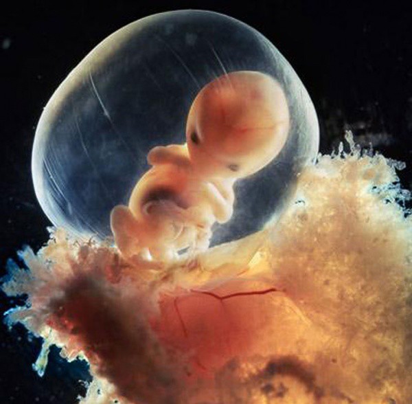 Как зарождается человеческая жизнь интересно, рождение человека, фото