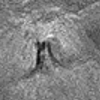 Фрагмент снимка Клементины с аномальным участком в кратере Ломоносова