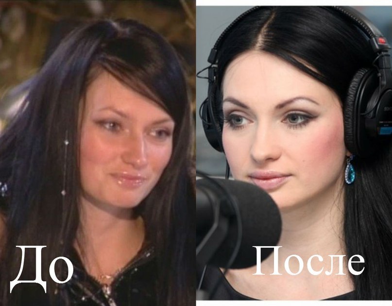 женя феофилактова до пластики фото смотреть