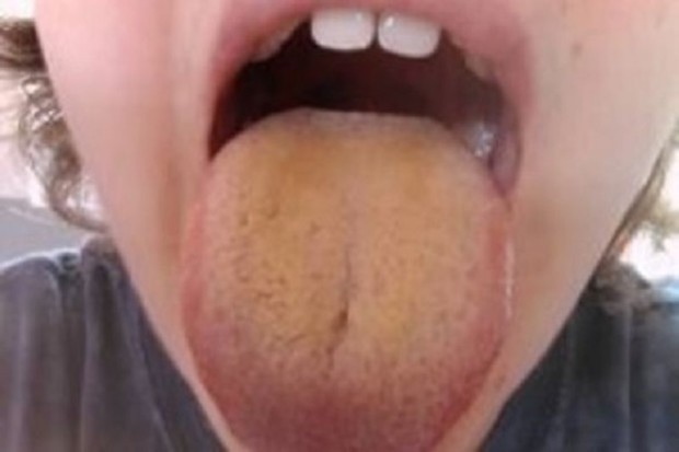 ,      , 