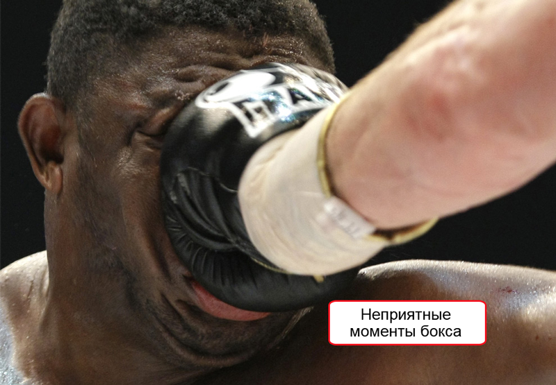 Неприятный момент в боксе Неприятный момент в боксе