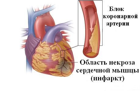 Пейте воду на пустой желудок сразу после пробуждения!