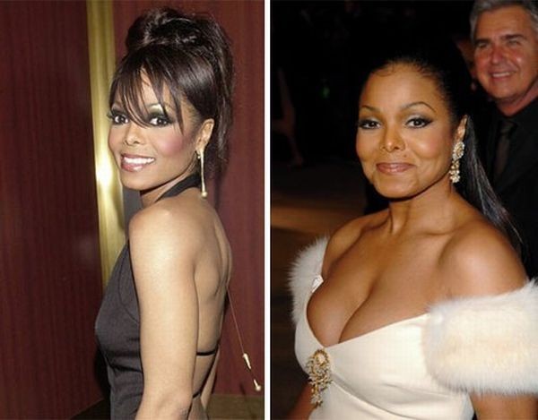 celebrities_before_and_after_boob_jobs_11