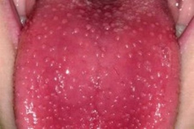,      , 