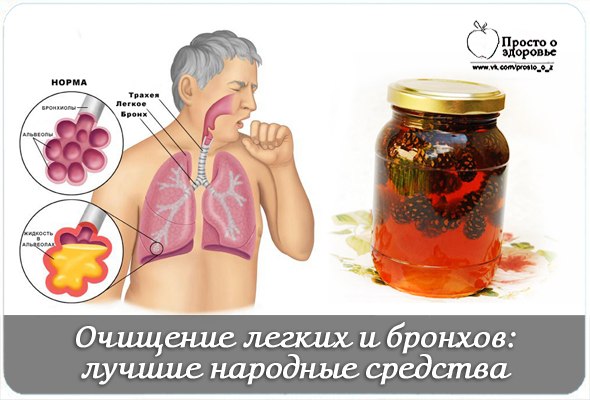 Как вывести мокроту с бронхов в домашних условиях Как вывести мокроту с бронхов в домашних условиях